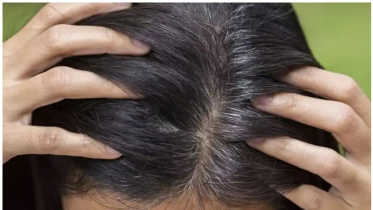 Health Tips : അകാലനര നിങ്ങളെ അലട്ടുന്നുണ്ടോ? കാരണങ്ങൾ അറിഞ്ഞിരിക്കാം