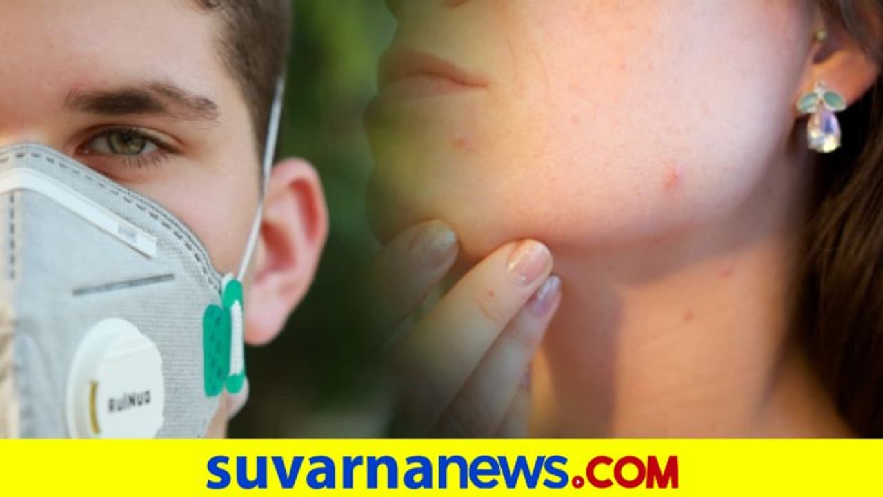 ಮಾಸ್ಕ್‌ನಿಂದ ಹೊಸ ಸ್ಕಿನ್ ಪ್ರಾಬ್ಲೆಂ..! ಹೆಚ್ಚುತ್ತಿದೆ ಪ್ರಕರಣ
