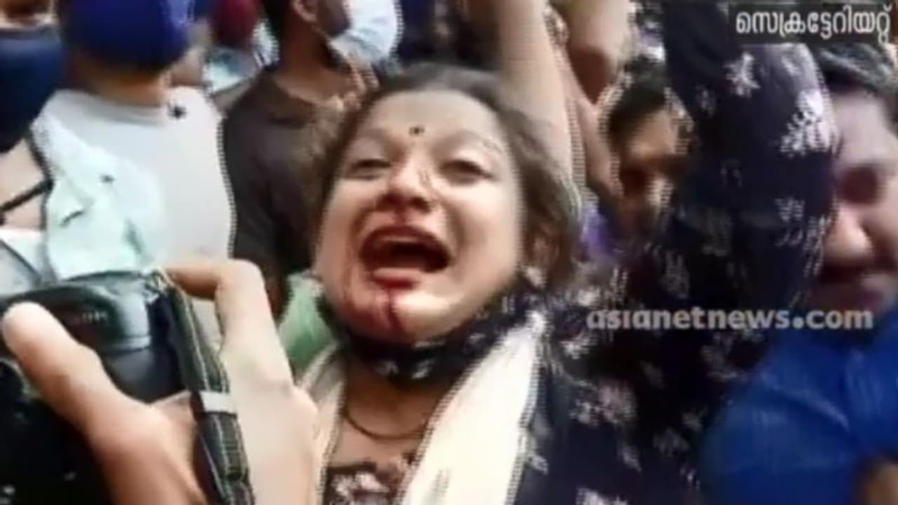 സമരങ്ങളോട് സർക്കാരിന് അസഹിഷ്ണുത, പ്രക്ഷോഭം കേരളമാകെ വ്യാപിപ്പിക്കും: ഷാഫി പറമ്പിൽ സമരങ്ങളോട് സർക്കാരിന് അസഹിഷ്ണുത, പ്രക്ഷോഭം കേരളമാകെ വ്യാപിപ്പിക്കും: ഷാഫി പറമ്പിൽ