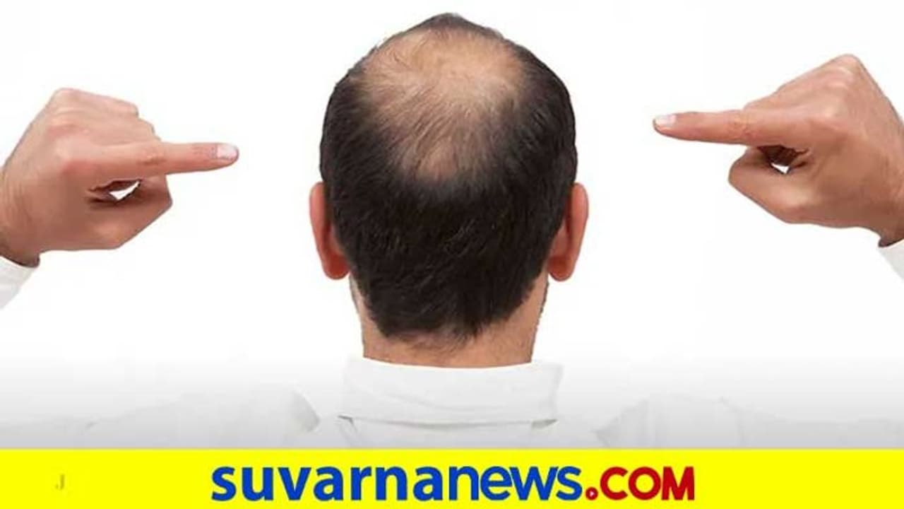 ಮದುವೆಗೆ ಮುನ್ನ ವಿಗ್ ಧರಿಸಿ ಬಾಲ್ಡಿ ತಲೆ ಮರೆಮಾಚಿದ್ದ ಗಂಡನಿಂದ ಬಿಡುಗಡೆ ಕೊಡಿಸಿ! ಮದುವೆಗೆ ಮುನ್ನ ವಿಗ್ ಧರಿಸಿ ಬಾಲ್ಡಿ ತಲೆ ಮರೆಮಾಚಿದ್ದ ಗಂಡನಿಂದ ಬಿಡುಗಡೆ ಕೊಡಿಸಿ!