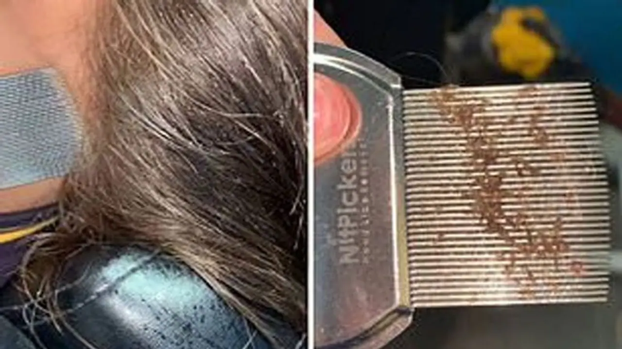 পুজোর আগেই সন্তানের মাথা থেকে দূর করুন উকুন, রইল সহজ টিপস পুজোর আগেই সন্তানের মাথা থেকে দূর করুন উকুন, রইল সহজ টিপস