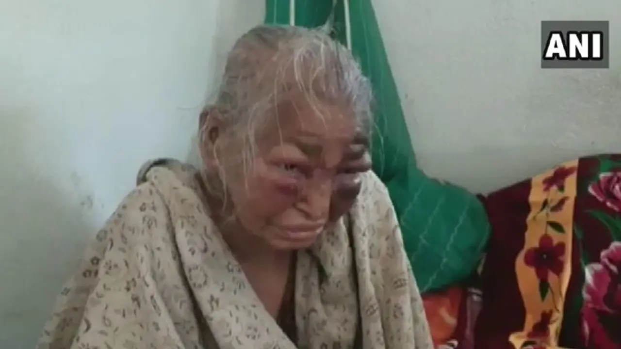 'তিনি কি বাংলার মা নন', রাজ্যের নির্যাতিতা মহিলার ছবি দিয়ে তৃণমূলকে নিশানা বিজেপি নেতার 'তিনি কি বাংলার মা নন', রাজ্যের নির্যাতিতা মহিলার ছবি দিয়ে তৃণমূলকে নিশানা বিজেপি নেতার