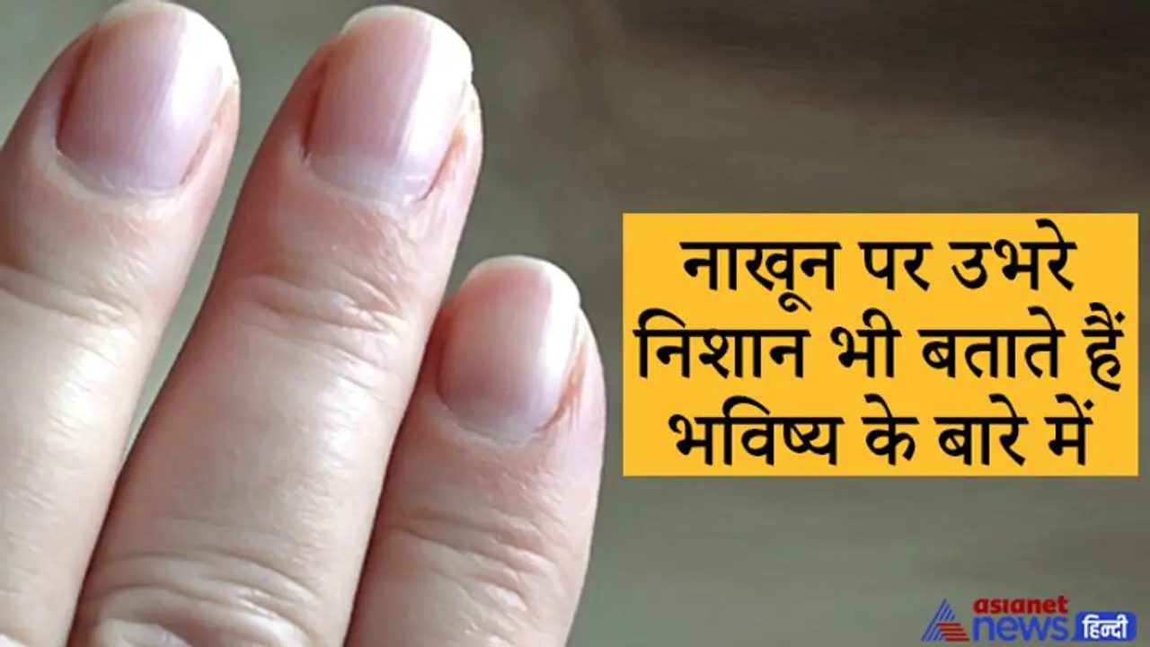 भविष्य में आने वाले संकट की सूचना देते हैं नाखून पर उभर आए काले निशान