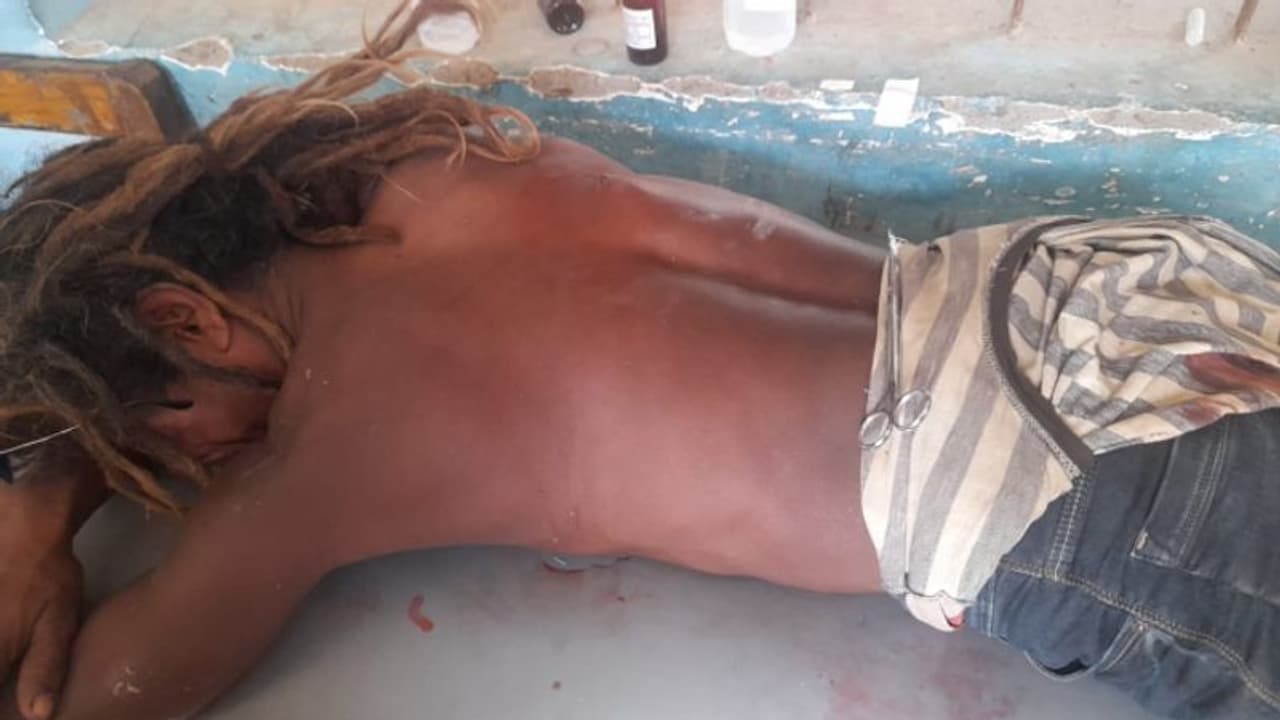 জয় শ্রী রাম বলায় বিজেপি কর্মীকে ধারাল অস্ত্রের কোপ, কাঠগড়ায় তৃণমূল কর্মী জয় শ্রী রাম বলায় বিজেপি কর্মীকে ধারাল অস্ত্রের কোপ, কাঠগড়ায় তৃণমূল কর্মী