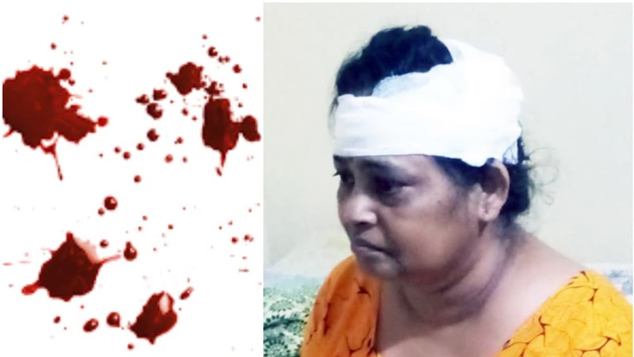 ബാങ്കിലേക്കുള്ള പടികൾ കയറുന്നതിനിടെ വഴുതി വീണ് വീട്ടമ്മയ്ക്ക് ഗുരുതര പരിക്ക് ബാങ്കിലേക്കുള്ള പടികൾ കയറുന്നതിനിടെ വഴുതി വീണ് വീട്ടമ്മയ്ക്ക് ഗുരുതര പരിക്ക്