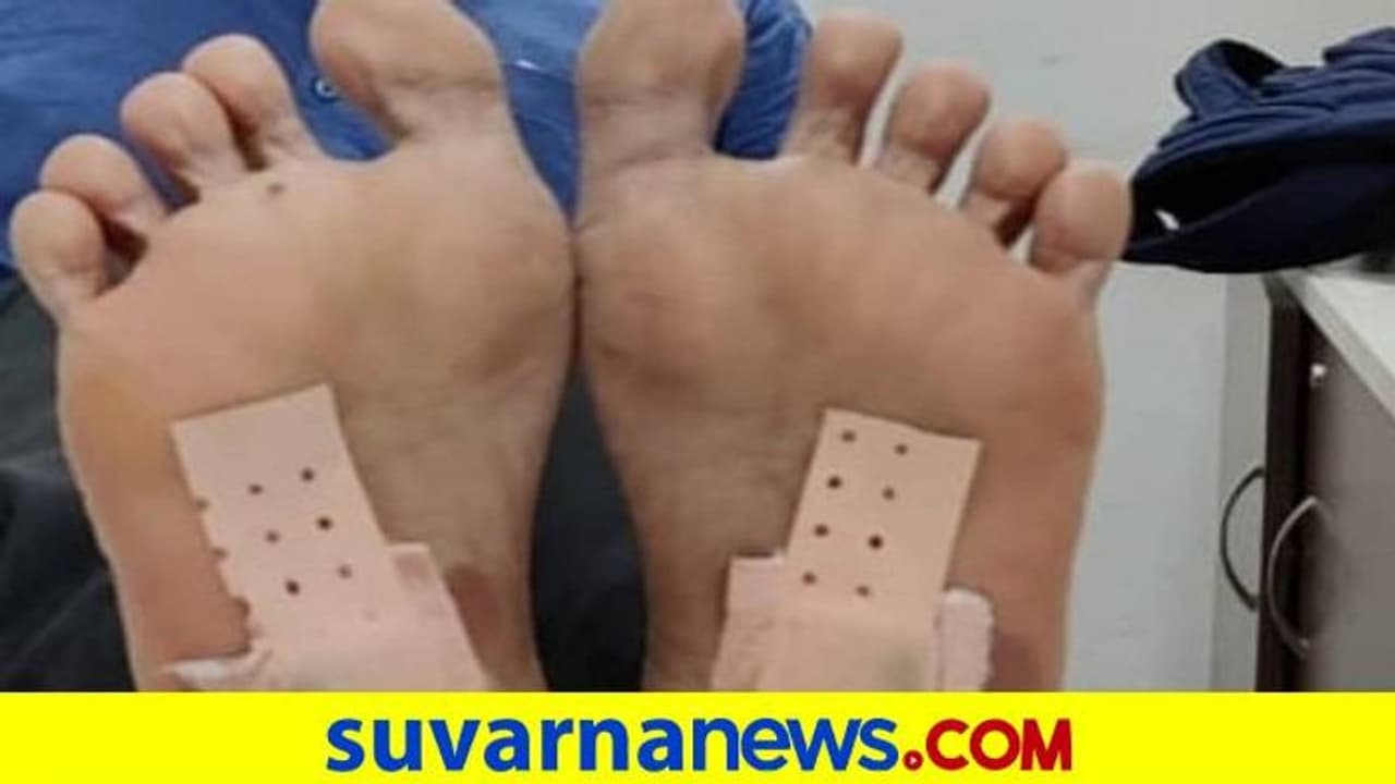 ಅಧಿಕಾರಿಗಳ ಕಣ್ತಪ್ಪಿಸಲು ಪಾದದಲ್ಲಿ ಚಿನ್ನವಿಟ್ಟ ಖದೀಮನ ಬಂಧನ ಅಧಿಕಾರಿಗಳ ಕಣ್ತಪ್ಪಿಸಲು ಪಾದದಲ್ಲಿ ಚಿನ್ನವಿಟ್ಟ ಖದೀಮನ ಬಂಧನ