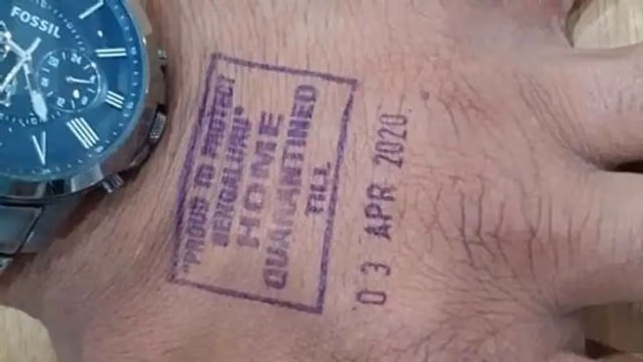 ಇಂದಿನಿಂದ ಕೊರೋನಾ ಸೋಂಕಿತರ ಕೈಗೆ ಸೀಲ್‌..!