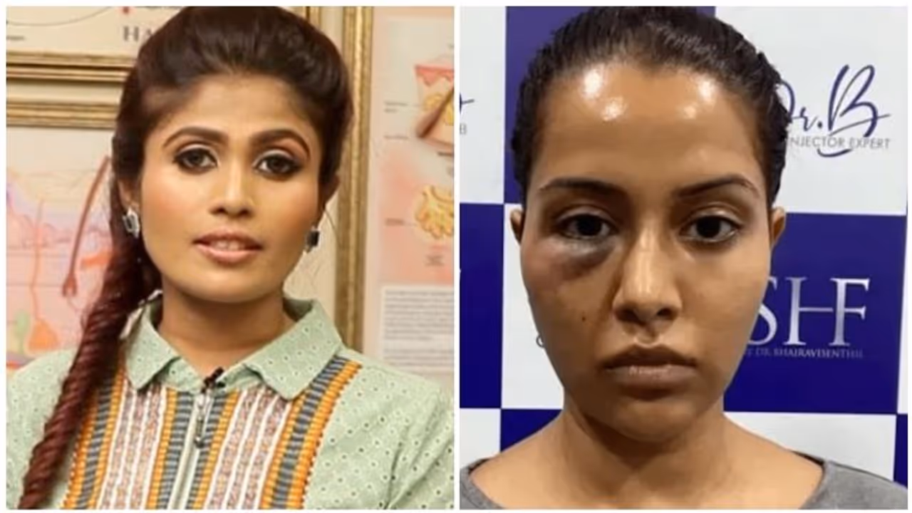 ரைசா முகம் வீங்க காரணம் என்ன?... முதன் முறையாக மருத்துவர் பைரவி வெளியிட்ட உண்மை... அதிர்ச்சியான மறுபக்கம்!