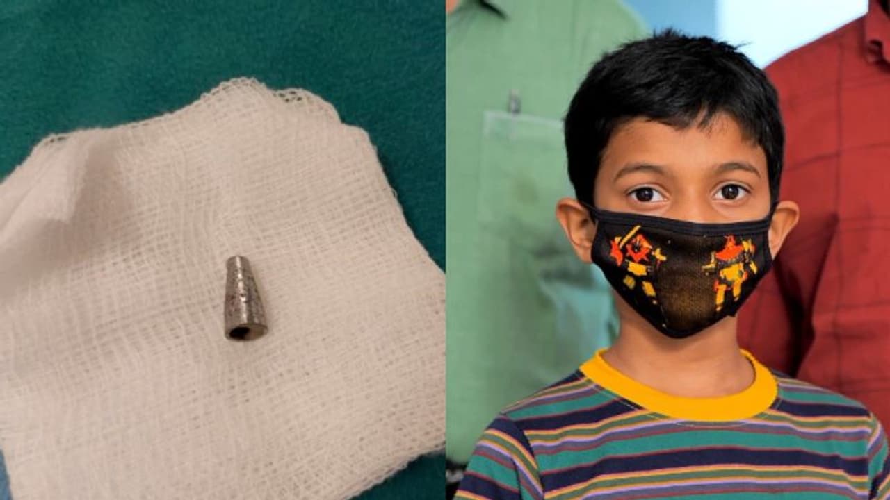 ഒരുമാസത്തിലേറെയായി മാറാത്ത ചുമ, പരിശോധനയില് ശ്വാസകോശത്തില് കണ്ടെത്തിയത് പേനയുടെ നിബ്ബ് ഒരുമാസത്തിലേറെയായി മാറാത്ത ചുമ, പരിശോധനയില് ശ്വാസകോശത്തില് കണ്ടെത്തിയത് പേനയുടെ നിബ്ബ്