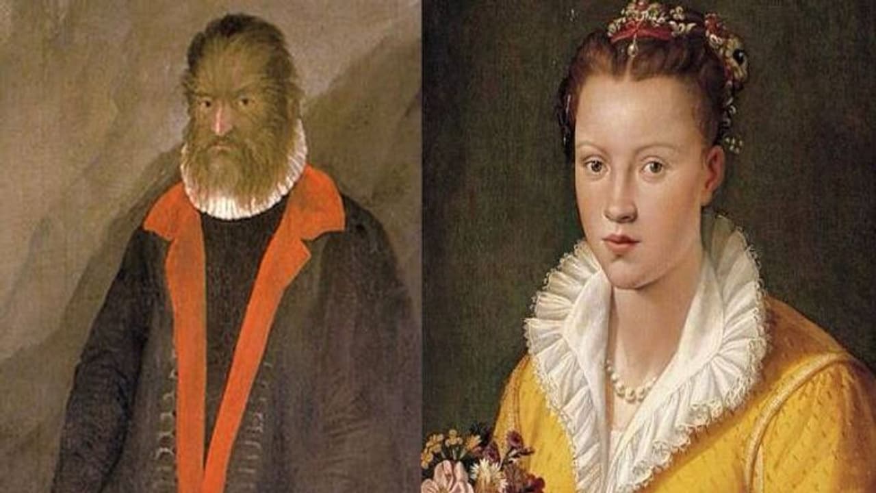 'ബ്യൂട്ടി ആൻഡ് ദ ബീസ്റ്റി'ന് കാരണമായ ജീവിതം, അവസാനകാലംവരെ മൃഗത്തെപോലെ കണക്കാക്കിയ മനുഷ്യൻ, സുന്ദരിയായ ഭാര്യ 'ബ്യൂട്ടി ആൻഡ് ദ ബീസ്റ്റി'ന് കാരണമായ ജീവിതം, അവസാനകാലംവരെ മൃഗത്തെപോലെ കണക്കാക്കിയ മനുഷ്യൻ, സുന്ദരിയായ ഭാര്യ