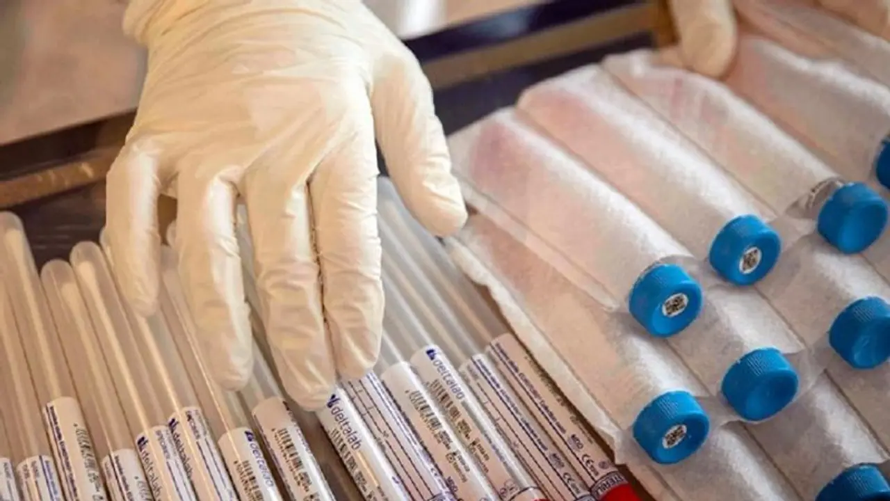 వెయిటింగ్‌లో 36 లక్షల మంది.. అందుబాటులో 4 లక్షల టీకాలే: తెలంగాణలో సెకండ్ డోస్‌కు ఇక్కట్లు