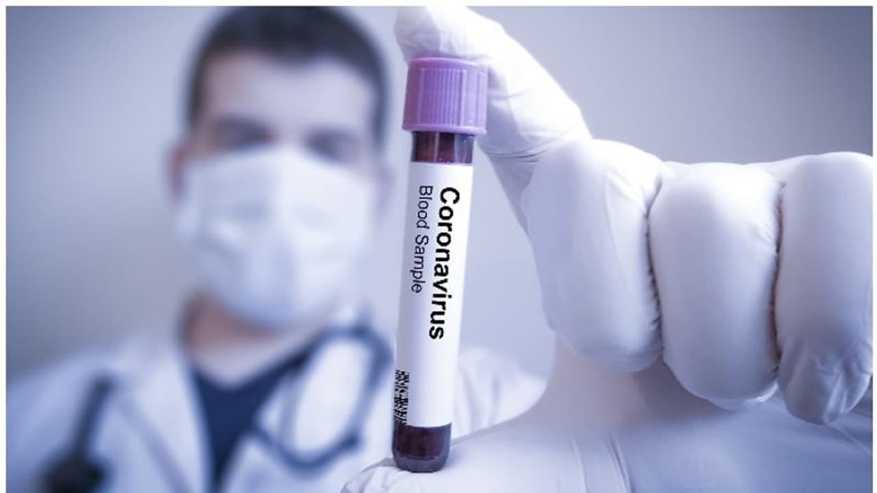 ഈ കൊവിഡ് കാലത്ത് ശ്രദ്ധിക്കേണ്ട മൂന്ന് കാര്യങ്ങളിതാ... ഈ കൊവിഡ് കാലത്ത് ശ്രദ്ധിക്കേണ്ട മൂന്ന് കാര്യങ്ങളിതാ...