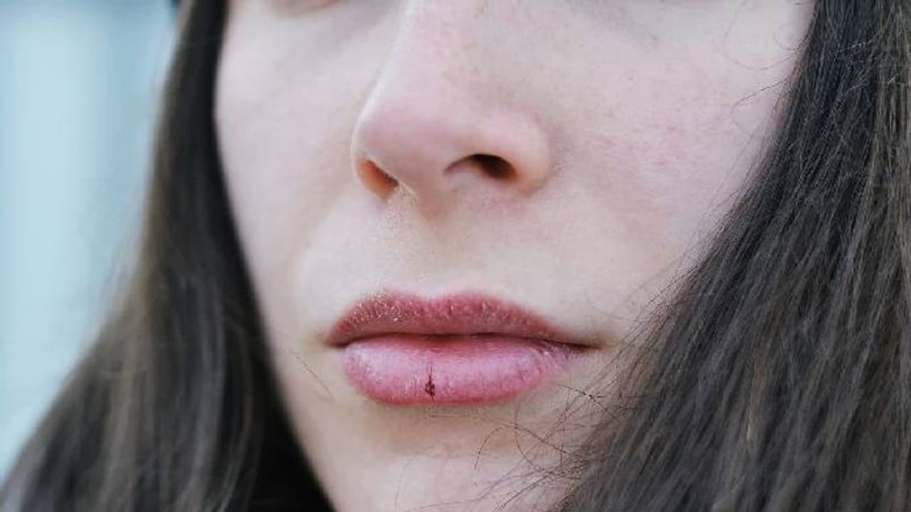 വരണ്ട ചുണ്ടിന് പരിഹാരമുണ്ട്; വീട്ടില്‍ പരീക്ഷിക്കാം ഈ വഴികള്‍...