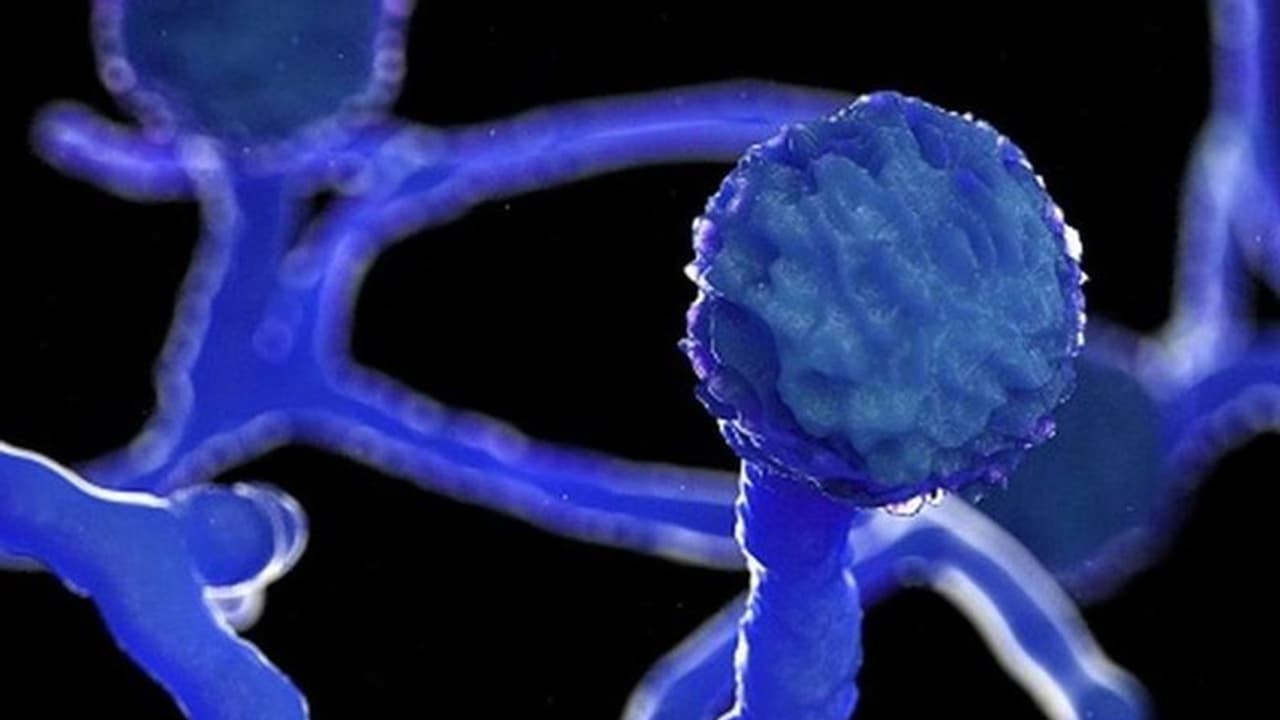 ఏపీలో తొలి బ్లాక్ ఫంగస్ కేసు: నిడదవోలు వ్యక్తిలో లక్షణాలు, స్థానికుల్లో ఆందోళన ఏపీలో తొలి బ్లాక్ ఫంగస్ కేసు: నిడదవోలు వ్యక్తిలో లక్షణాలు, స్థానికుల్లో ఆందోళన