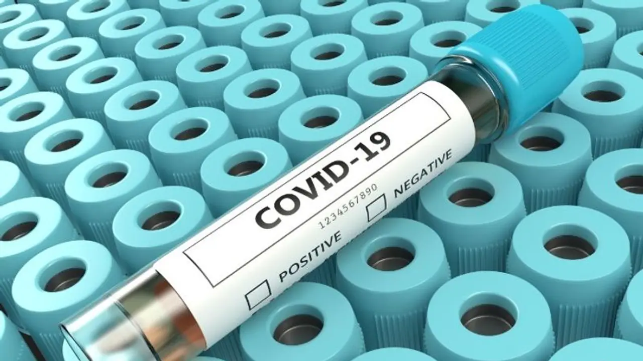 Covid 19 India : 'കൊവിഡ് മൂന്നാം തരംഗം മൂര്ദ്ധന്യത്തിലെത്തുക ഈ ദിവസങ്ങളില്...' Covid 19 India : 'കൊവിഡ് മൂന്നാം തരംഗം മൂര്ദ്ധന്യത്തിലെത്തുക ഈ ദിവസങ്ങളില്...'