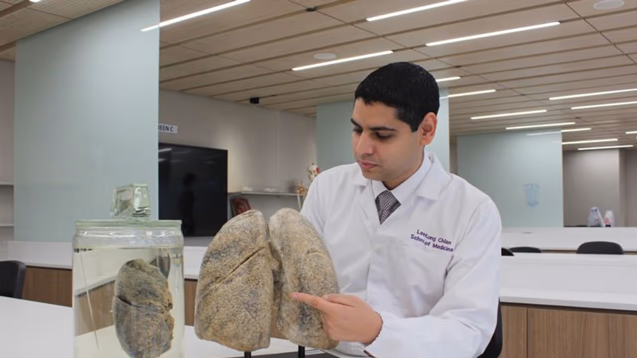 Bacteria, viruses, and fungi work as a network in causing lung infection: NTU Singapore study Bacteria, viruses, and fungi work as a network in causing lung infection: NTU Singapore study