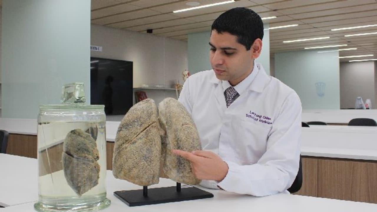 ভাইরাস ব্যাকটিরিয়া ফাঙ্গাস, ফুসফুসের সংক্রমণে নেটওয়ার্ক বলল NTU সিঙ্গাপুর