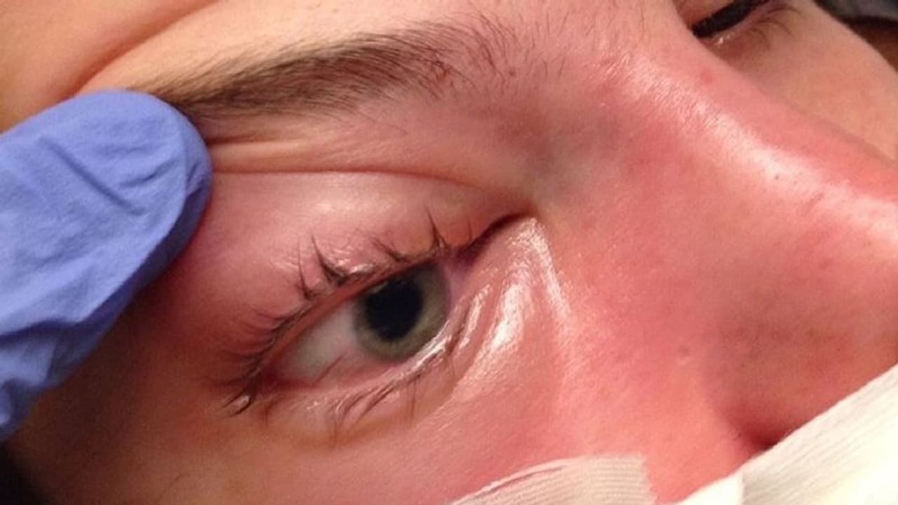 'ബ്ലാക്ക് ഫംഗസ്' രാജസ്ഥാനില് പകര്ച്ചവ്യാധിയായി പ്രഖ്യാപിക്കപ്പെട്ടു 'ബ്ലാക്ക് ഫംഗസ്' രാജസ്ഥാനില് പകര്ച്ചവ്യാധിയായി പ്രഖ്യാപിക്കപ്പെട്ടു