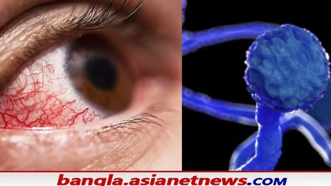 ব্ল্যাক ফাংগাসে আক্রান্ত হয়ে ফের মৃত্যু বাংলায়, ডায়বেটিকদের ক্ষেত্রে এই রোগ কতটা আশঙ্কাজনক ব্ল্যাক ফাংগাসে আক্রান্ত হয়ে ফের মৃত্যু বাংলায়, ডায়বেটিকদের ক্ষেত্রে এই রোগ কতটা আশঙ্কাজনক
