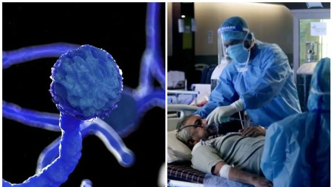 ബ്ലാക്ക് ഫംഗസ് പ്രമേഹമുള്ളവരിൽ ഗുരുതരമാകാൻ കാരണമെന്ത്...? ഡോക്ടർ പറയുന്നു ബ്ലാക്ക് ഫംഗസ് പ്രമേഹമുള്ളവരിൽ ഗുരുതരമാകാൻ കാരണമെന്ത്...? ഡോക്ടർ പറയുന്നു