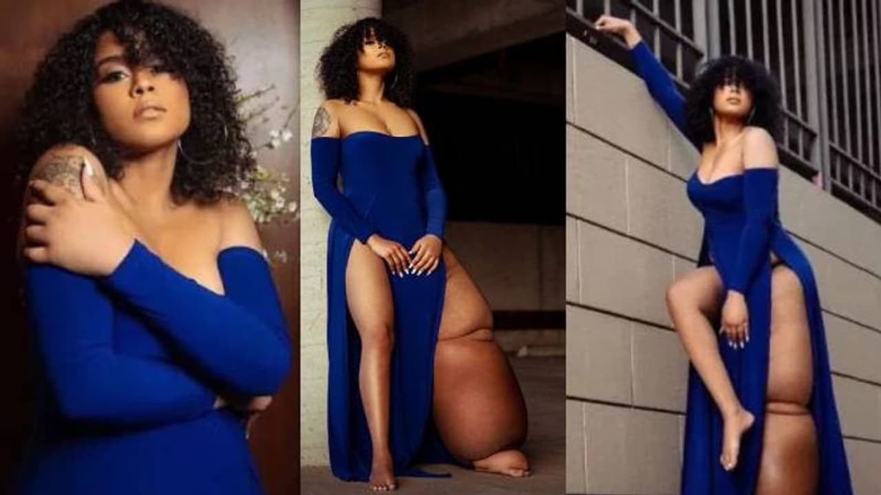 'കാല് മുറിച്ചു കളഞ്ഞുകൂടെ'; പരിഹസിക്കുന്നവരോട് മഹോഗാനിക്ക് പറയാനുള്ളത്... 'കാല് മുറിച്ചു കളഞ്ഞുകൂടെ'; പരിഹസിക്കുന്നവരോട് മഹോഗാനിക്ക് പറയാനുള്ളത്...