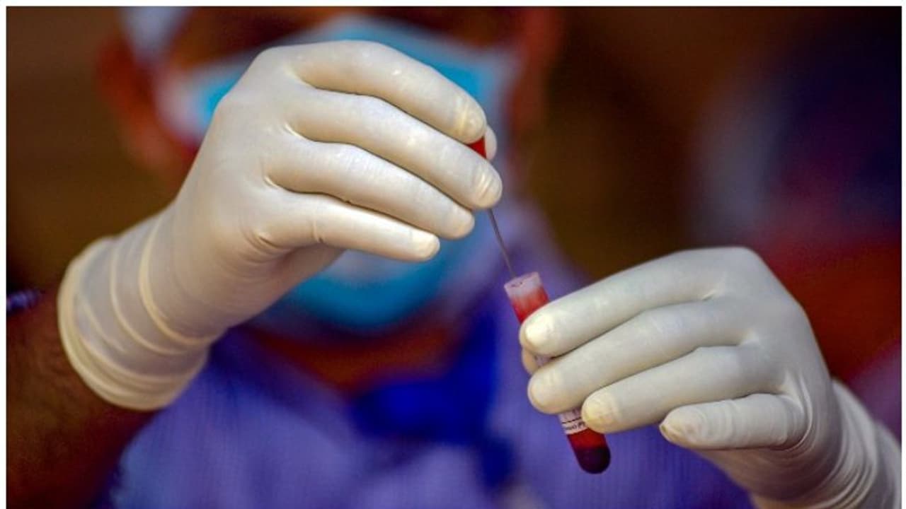 ടെസ്റ്റോസ്റ്റിറോണ് കുറഞ്ഞ പുരുഷന്മാരില് കൊവിഡ് 19 ഗുരുതരമായേക്കാമെന്ന് പുതിയ പഠനം ടെസ്റ്റോസ്റ്റിറോണ് കുറഞ്ഞ പുരുഷന്മാരില് കൊവിഡ് 19 ഗുരുതരമായേക്കാമെന്ന് പുതിയ പഠനം