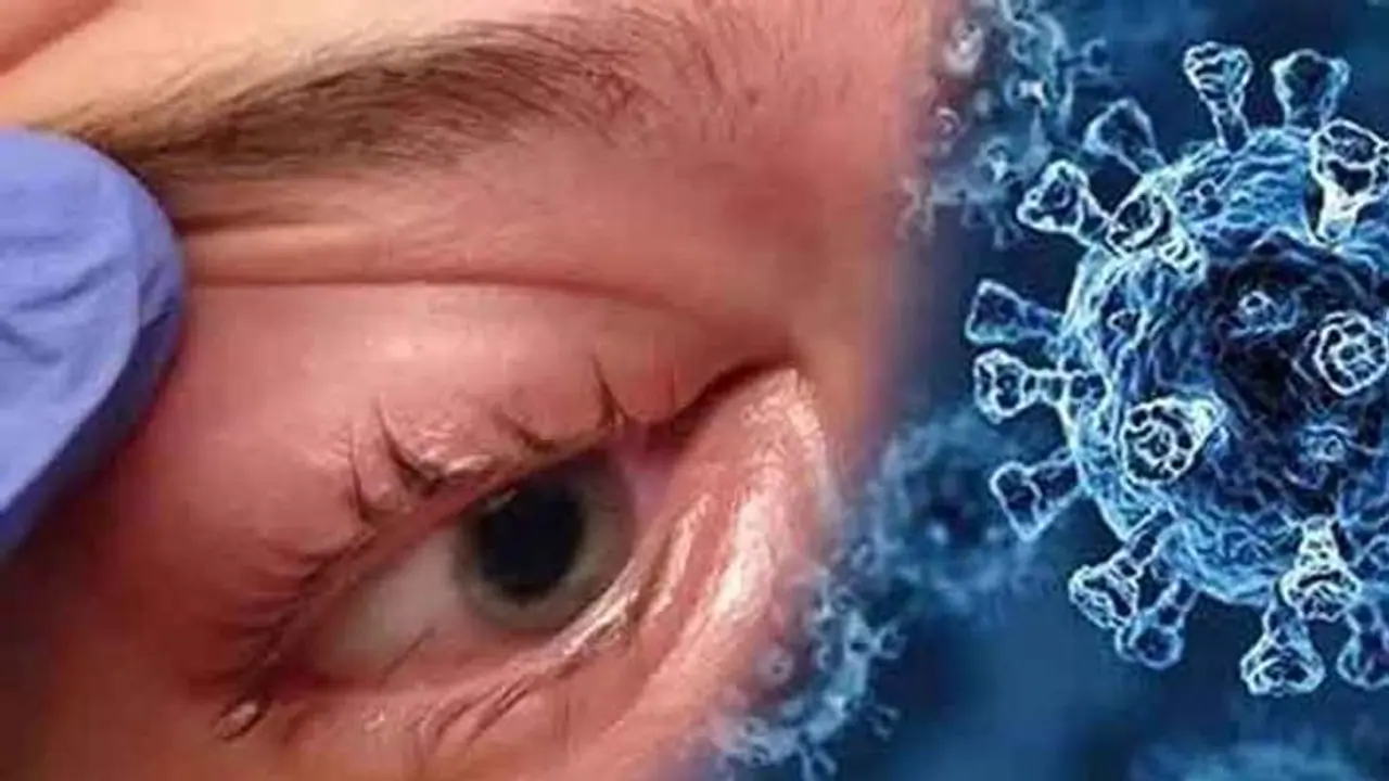 ರಾಜ್ಯದಲ್ಲಿ ಈವರೆಗೆ ಎಷ್ಟು ಬ್ಲ್ಯಾಕ್ ಫಂಗಸ್ ಕೇಸ್? ಎಷ್ಟುಸಾವು? ಗುಣಮುಖವೆಷ್ಟು? ರಾಜ್ಯದಲ್ಲಿ ಈವರೆಗೆ ಎಷ್ಟು ಬ್ಲ್ಯಾಕ್ ಫಂಗಸ್ ಕೇಸ್? ಎಷ್ಟುಸಾವು? ಗುಣಮುಖವೆಷ್ಟು?