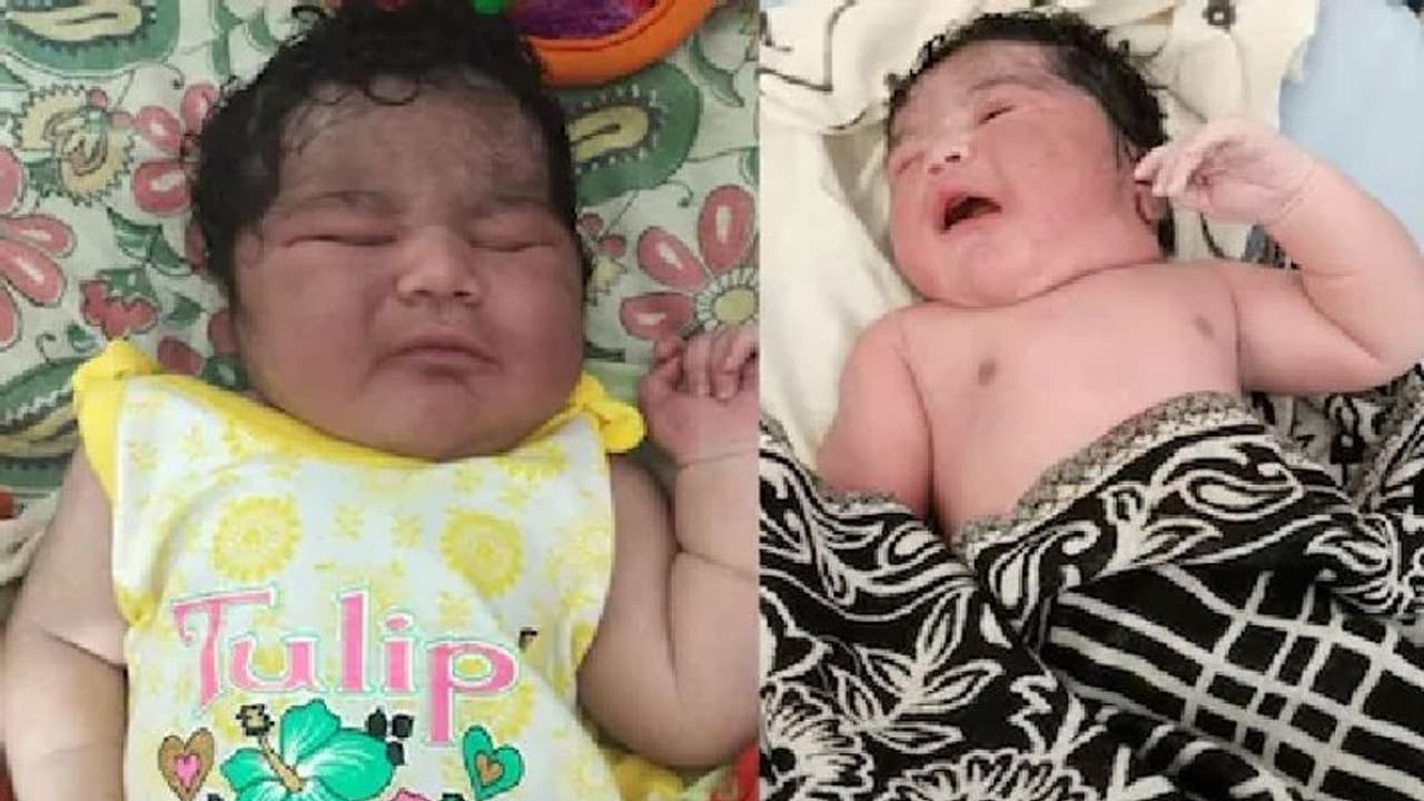 MP में जन्मी सबसे अद्भुत ही बच्ची, जिसे देखकर यकीन करना था मुश्किल..डॉक्टर्स बोले यह दुर्लभ मामला MP में जन्मी सबसे अद्भुत ही बच्ची, जिसे देखकर यकीन करना था मुश्किल..डॉक्टर्स बोले यह दुर्लभ मामला