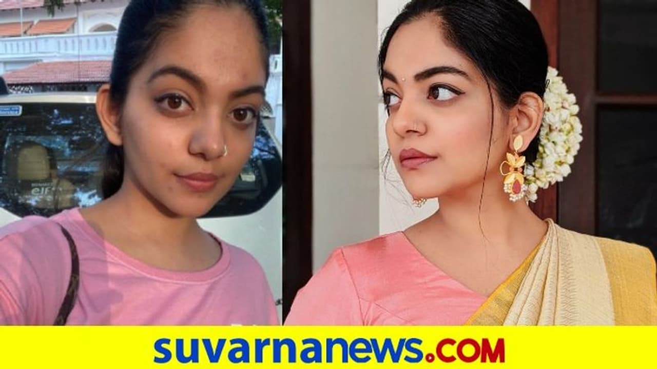 ಚಿಕನ್ ಪಾಕ್ಸ್ಗೆ ಗಾಬರಿ ಬೇಡ, ಏನೇ ಮಾರ್ಕ್ ಇದ್ದರೂ ಹೋಗುತ್ತದೆ: ನಟಿ ಆಹಾನ ಕೃಷ್ಣ ಚಿಕನ್ ಪಾಕ್ಸ್ಗೆ ಗಾಬರಿ ಬೇಡ, ಏನೇ ಮಾರ್ಕ್ ಇದ್ದರೂ ಹೋಗುತ್ತದೆ: ನಟಿ ಆಹಾನ ಕೃಷ್ಣ