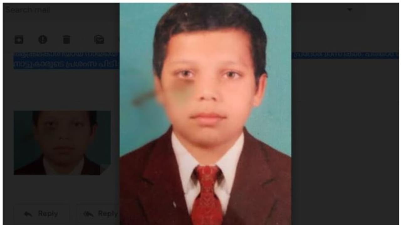 ആക്രമിക്കാനെത്തിയ തെരുവുനായയെ തിരിച്ചാക്രമിച്ച് പത്താംക്ലാസുകാരന്; നായ ചത്തു, കുട്ടിക്ക് കടിയേറ്റു ആക്രമിക്കാനെത്തിയ തെരുവുനായയെ തിരിച്ചാക്രമിച്ച് പത്താംക്ലാസുകാരന്; നായ ചത്തു, കുട്ടിക്ക് കടിയേറ്റു