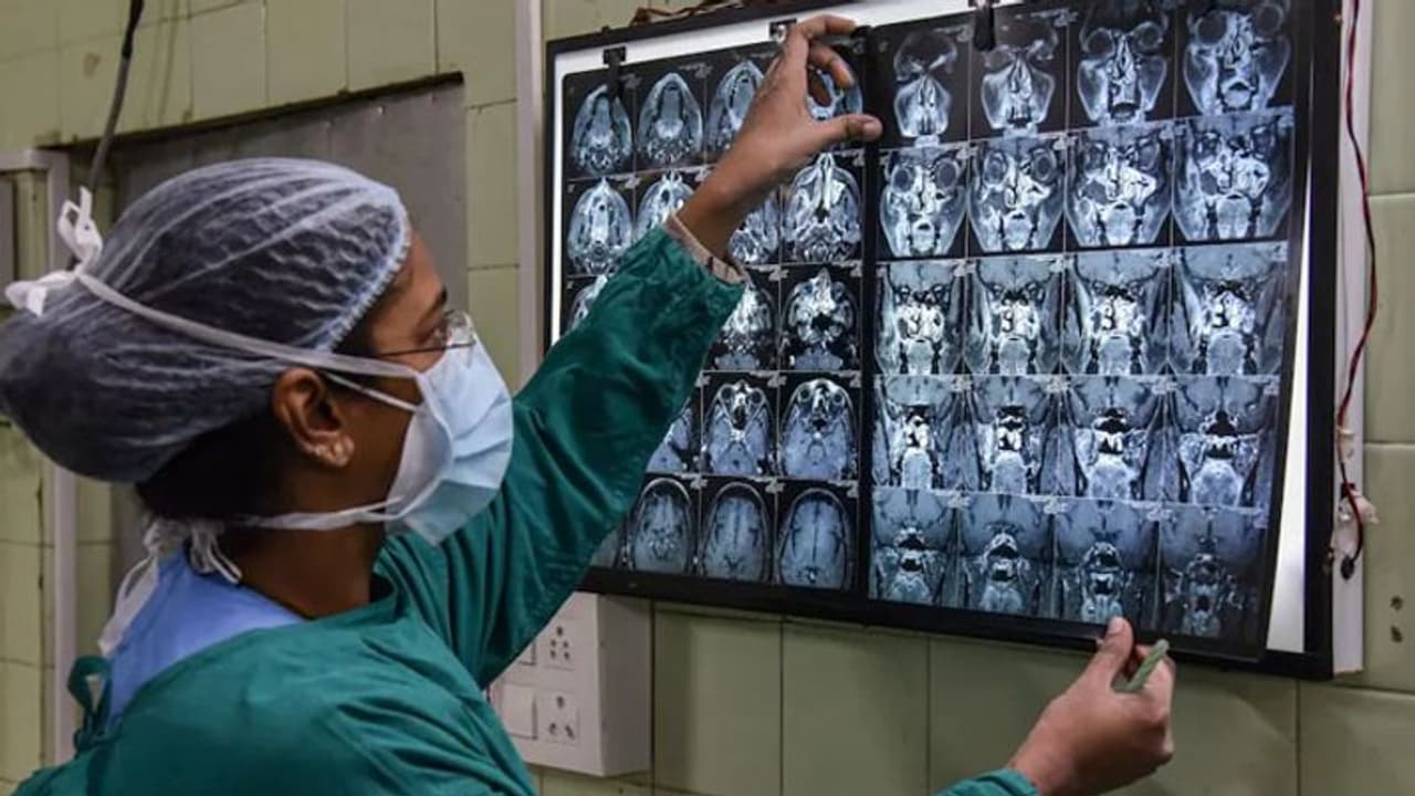 Green fungus: এবার দেশে সবুজ ছত্রাকের হানা, করোনাজয়ীর শরীরে মিলল Green fungus Green fungus: এবার দেশে সবুজ ছত্রাকের হানা, করোনাজয়ীর শরীরে মিলল Green fungus