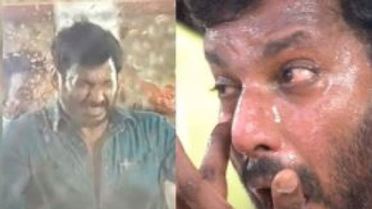 Vishal: హీరో విశాల్ కి తీవ్రగాయాలు.. షూటింగ్ లో ఊహించని ప్రమాదం, ఏం జరిగిందంటే Vishal: హీరో విశాల్ కి తీవ్రగాయాలు.. షూటింగ్ లో ఊహించని ప్రమాదం, ఏం జరిగిందంటే