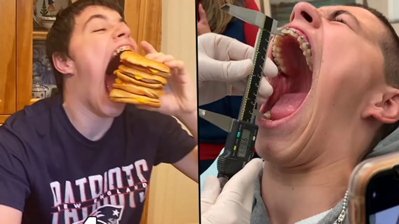 US Teenager sets Guinness World Record For Largest Mouth Gape; Watch Video US Teenager sets Guinness World Record For Largest Mouth Gape; Watch Video