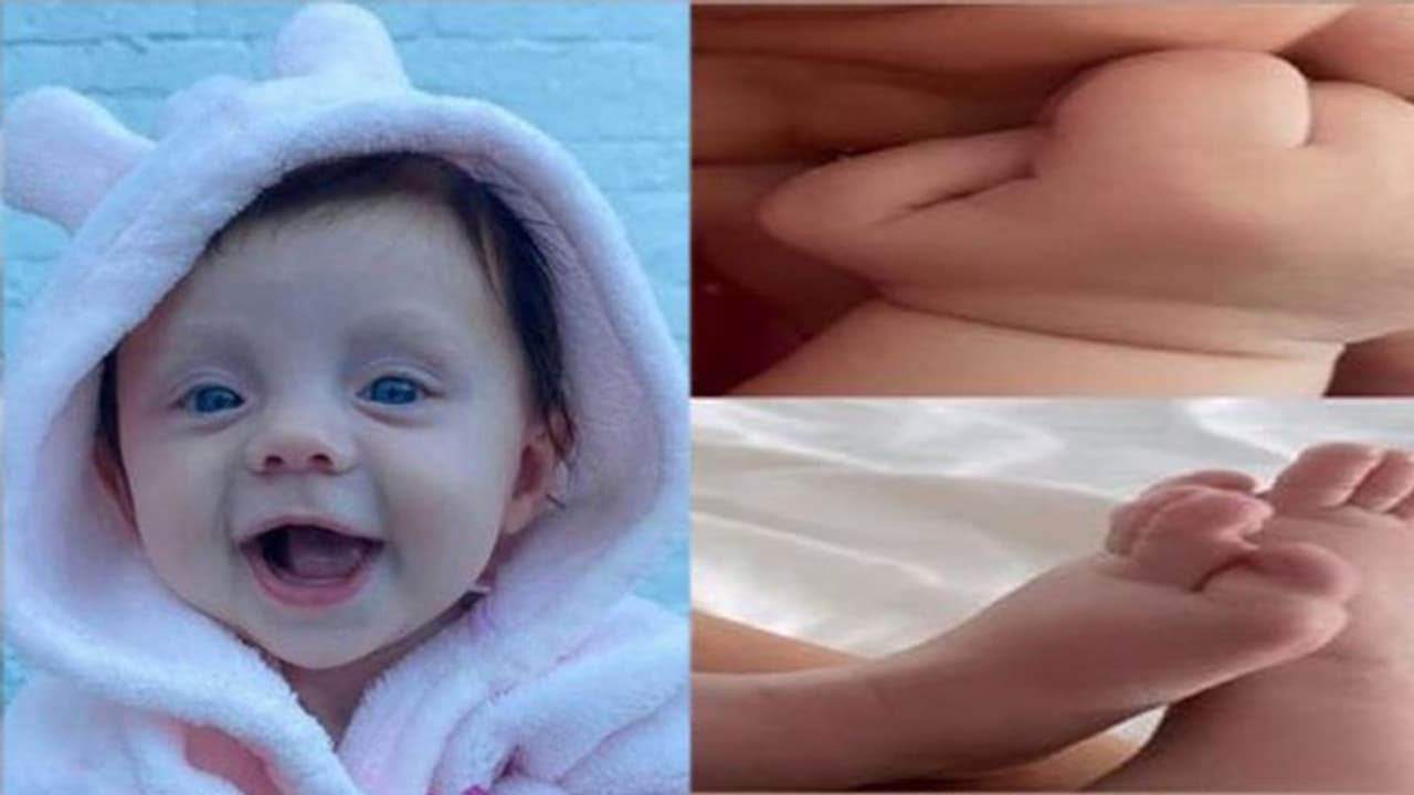 లక్షల్లో ఒకరికి వచ్చే అరుదైన వ్యాధి.. రాయిగా మారుతోన్న ఐదు నెలల చిన్నారి లక్షల్లో ఒకరికి వచ్చే అరుదైన వ్యాధి.. రాయిగా మారుతోన్న ఐదు నెలల చిన్నారి