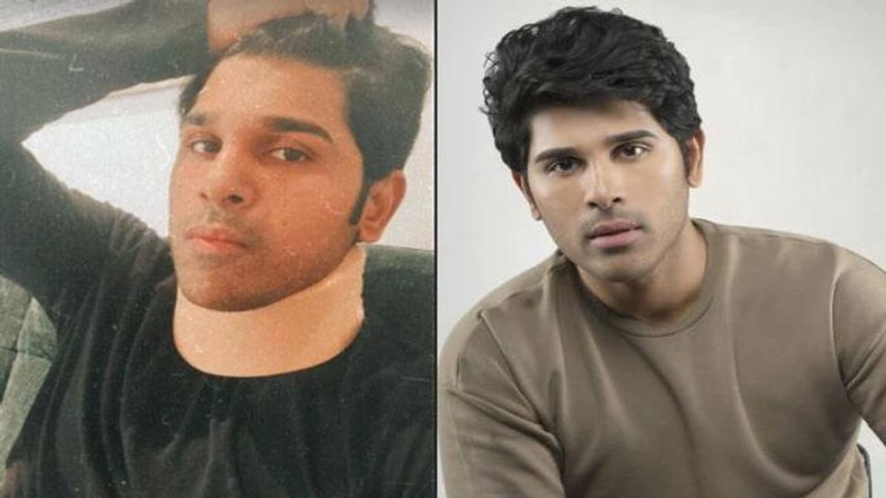 అల్లు శిరీష్ మెడకు గాయం.. ఏం జరిగిందంటే? అల్లు శిరీష్ మెడకు గాయం.. ఏం జరిగిందంటే?