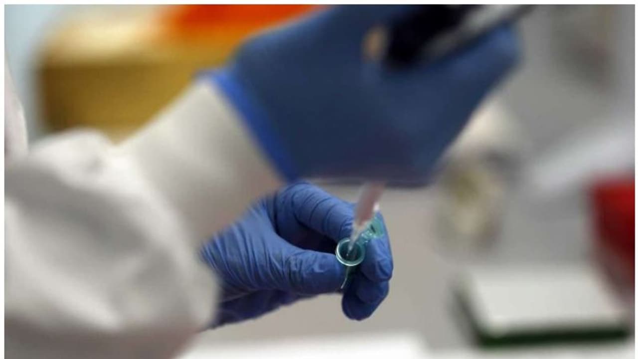 കൊവിഡ്‌ ബാധിച്ച് മരിച്ച 90കാരിയില്‍ ഒരേ സമയം ആൽഫ, ബീറ്റ വകഭേദങ്ങൾ കണ്ടെത്തി; ഇത് അപൂര്‍വമെന്ന് വിദഗ്ധര്‍