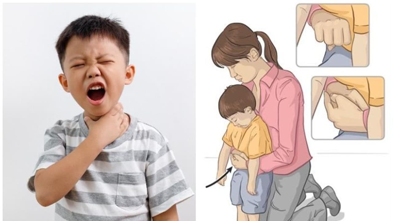 കുട്ടികളുടെ തൊണ്ടയിൽ ഭക്ഷണമോ നാണയമോ കുടുങ്ങിയാല് എന്താണ് ചെയ്യേണ്ടത്...? ഡോക്ടർ പറയുന്നു കുട്ടികളുടെ തൊണ്ടയിൽ ഭക്ഷണമോ നാണയമോ കുടുങ്ങിയാല് എന്താണ് ചെയ്യേണ്ടത്...? ഡോക്ടർ പറയുന്നു