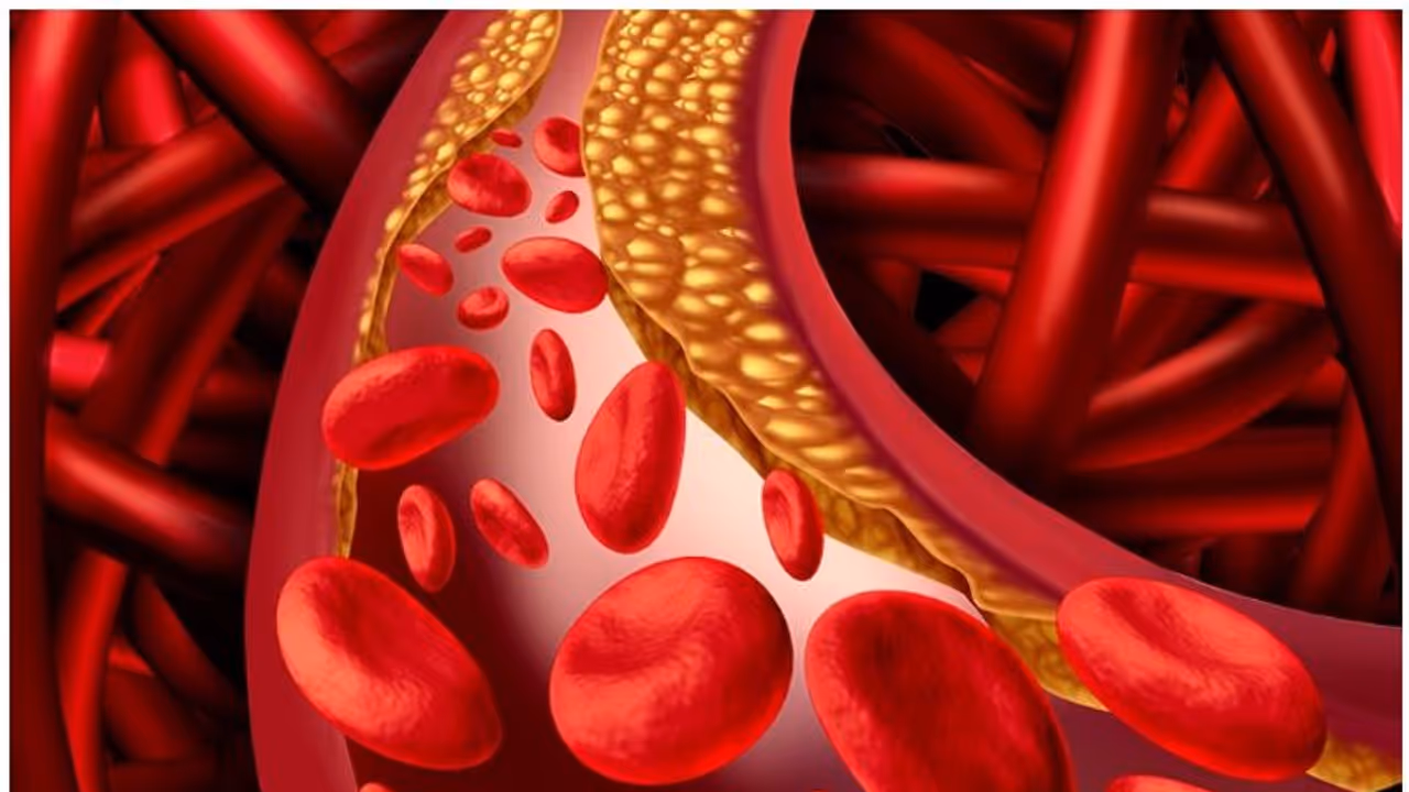 ചീത്ത കൊളസ്ട്രോൾ കുറയ്ക്കാൻ ഇവ ശ്രദ്ധിക്കാം