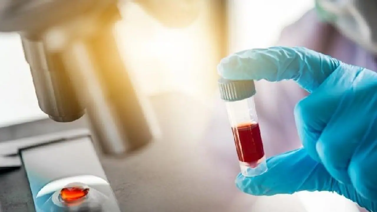 ஆண்டவன் இருக்கான்.. மூன்றாவது அலை வந்தாலும் தமிழ்நாட்டுக்கு கவலை இல்ல.? ஐசிஎம்ஆர் வெளியிட்ட ரிப்போர்ட். ஆண்டவன் இருக்கான்.. மூன்றாவது அலை வந்தாலும் தமிழ்நாட்டுக்கு கவலை இல்ல.? ஐசிஎம்ஆர் வெளியிட்ட ரிப்போர்ட்.