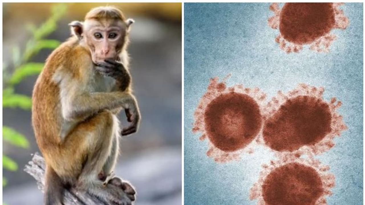 എന്താണ് മങ്കി ബി വൈറസ്? പ്രതിരോധിക്കാൻ ചെയ്യേണ്ട അഞ്ച് കാര്യങ്ങൾ