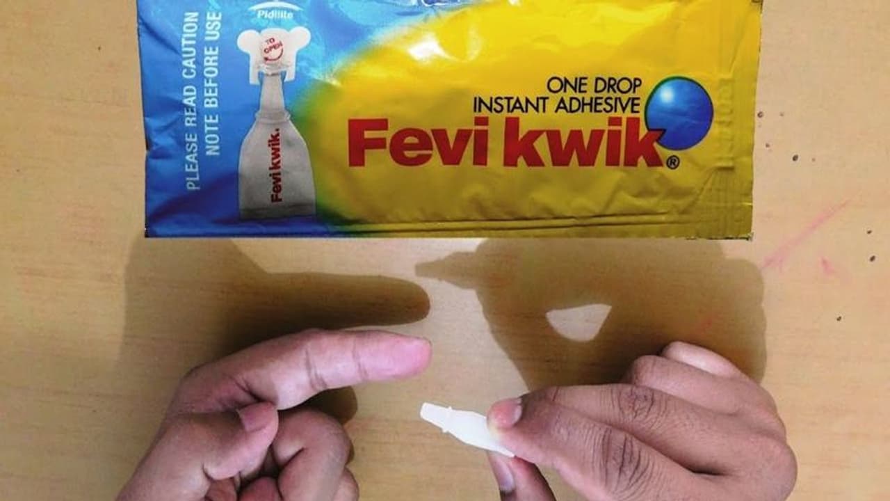 ಯಪ್ಪಾ..ಗಾಯಕ್ಕೆ ಹೊಲಿಗೆ ಹಾಕುವ ಬದಲು ಫೆವಿಕ್ವಿಕ್ ಹಾಕಿದ ಡಾಕ್ಟರ್! ಯಪ್ಪಾ..ಗಾಯಕ್ಕೆ ಹೊಲಿಗೆ ಹಾಕುವ ಬದಲು ಫೆವಿಕ್ವಿಕ್ ಹಾಕಿದ ಡಾಕ್ಟರ್!