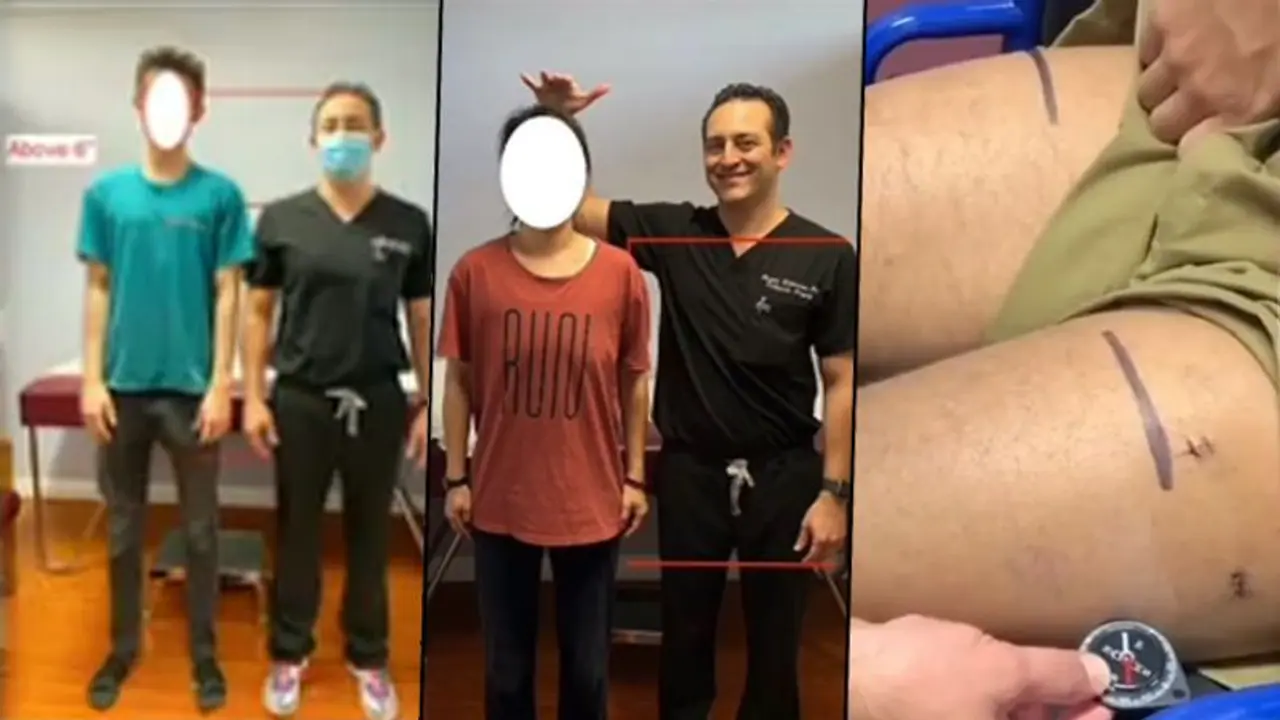 Doctor claims he can make patients taller; watch video