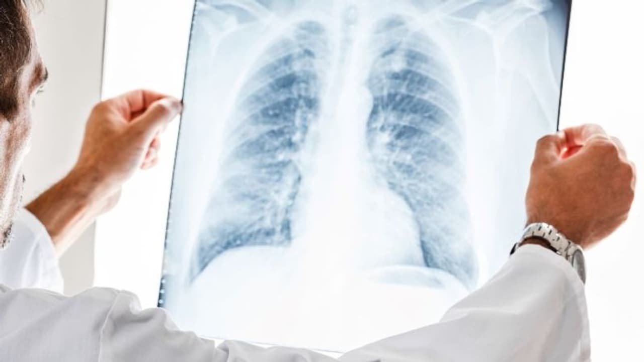 ആസ്ത്മയെന്ന് കരുതി ദീര്‍ഘകാല ചികിത്സ; 18 വർഷത്തിനു ശേഷം പുറത്തെടുത്ത് പേനയുടെ അഗ്രം!