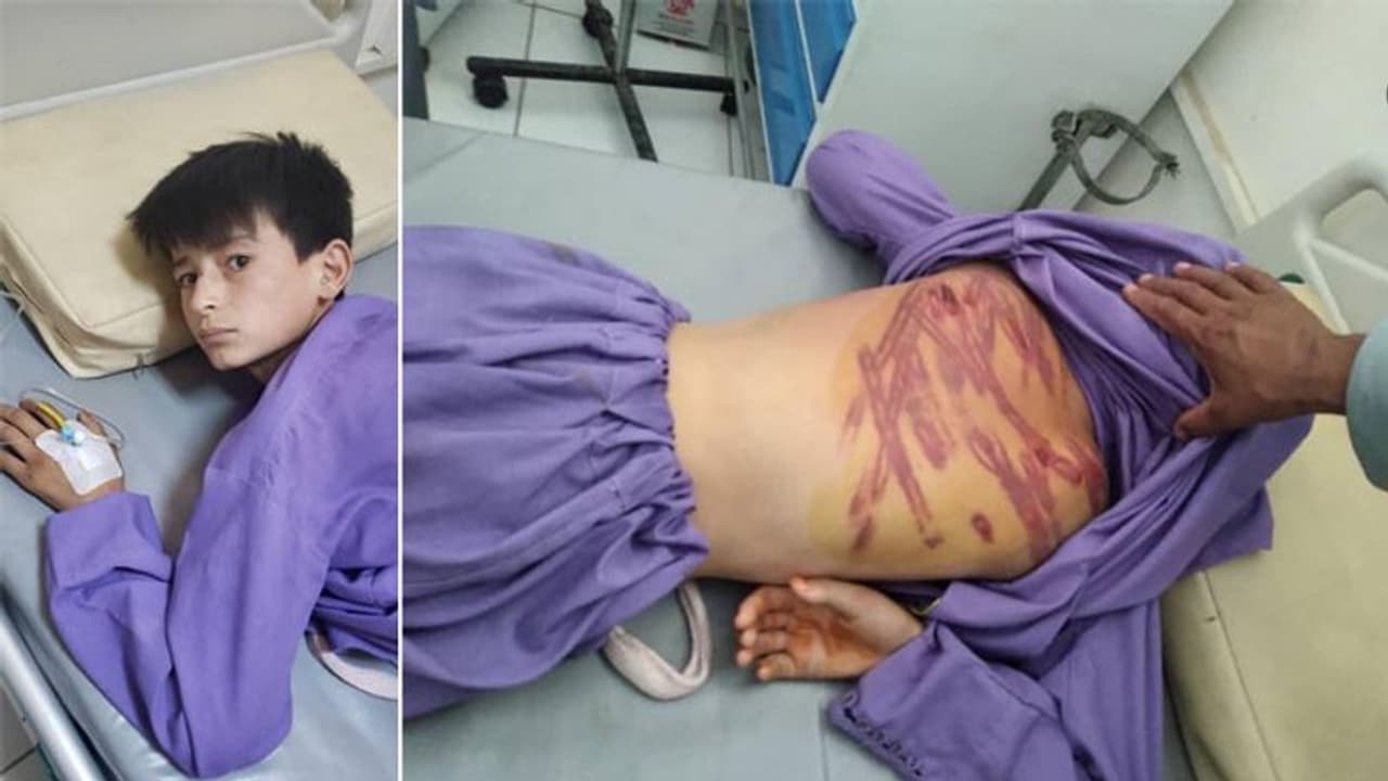 #afganistan: पिता से दुश्मनी निकालने तालिबानी लड़ाकों ने 100 कोड़े मारकर मासूम की पीठ कर दी छलनी #afganistan: पिता से दुश्मनी निकालने तालिबानी लड़ाकों ने 100 कोड़े मारकर मासूम की पीठ कर दी छलनी