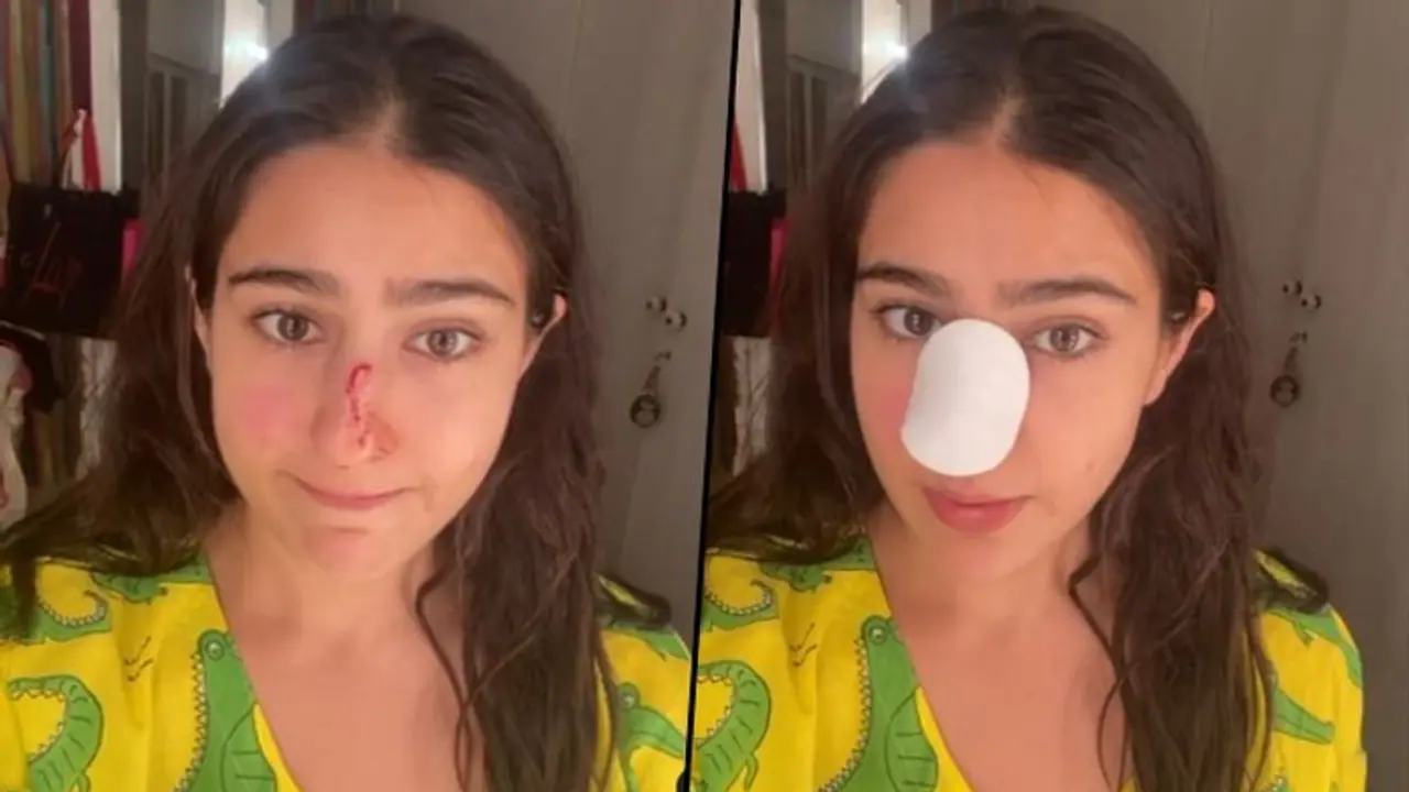 Sara Ali Khan shares funny video, shows her nose injury; watch here Sara Ali Khan shares funny video, shows her nose injury; watch here