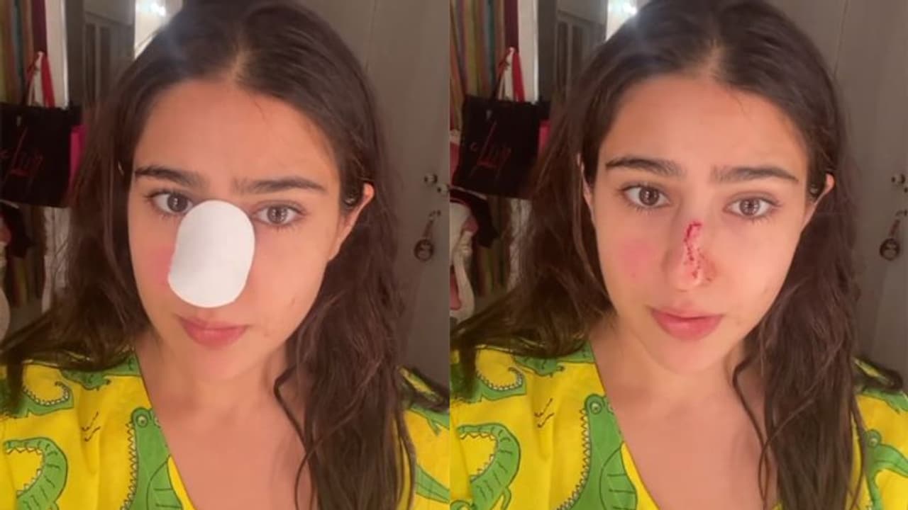 নাক কেটে ফিরলেন সারা, মুহূর্তে মা বাবাার উদ্দেশ্যে কী বললেন সইফ কন্যা নাক কেটে ফিরলেন সারা, মুহূর্তে মা বাবাার উদ্দেশ্যে কী বললেন সইফ কন্যা