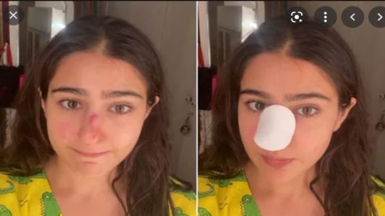 సారా అలీ ఖాన్ ముక్కు పగిలింది.. కొట్టిందెవరు? సారా అలీ ఖాన్ ముక్కు పగిలింది.. కొట్టిందెవరు?