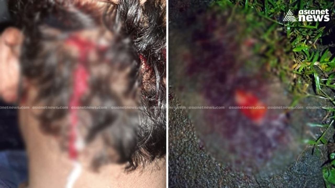 കോഴിക്കോട് സിപിഐ വിട്ട് സിപിഎമ്മിൽ ചേർന്നയാളുടെ തല അടിച്ച് പൊട്ടിച്ചു കോഴിക്കോട് സിപിഐ വിട്ട് സിപിഎമ്മിൽ ചേർന്നയാളുടെ തല അടിച്ച് പൊട്ടിച്ചു