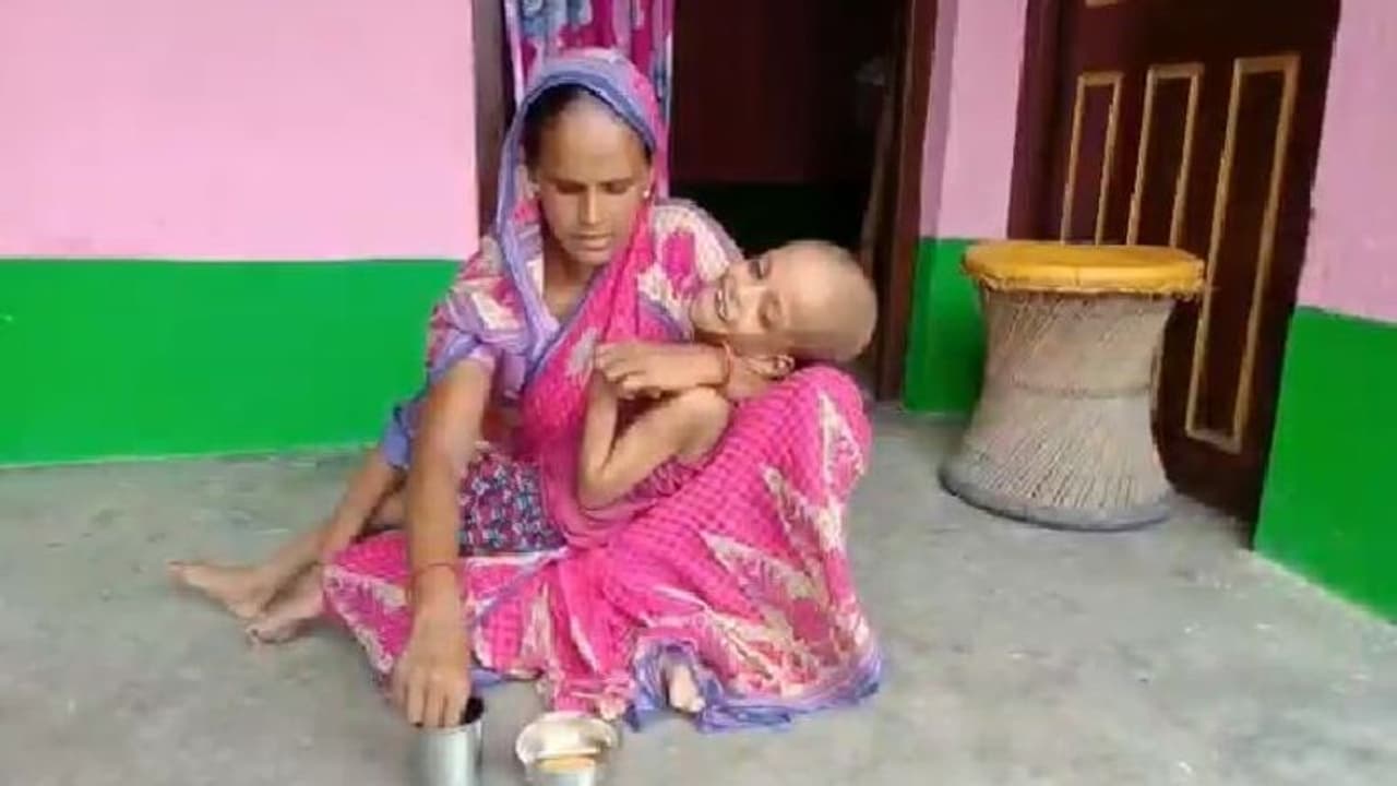 গরীব বাবা মা পাননি স্বাস্থ্যসাথী কার্ড, মৃত্যুর দিকে এগোচ্ছে জটিল রোগে আক্রান্ত শিশু গরীব বাবা মা পাননি স্বাস্থ্যসাথী কার্ড, মৃত্যুর দিকে এগোচ্ছে জটিল রোগে আক্রান্ত শিশু