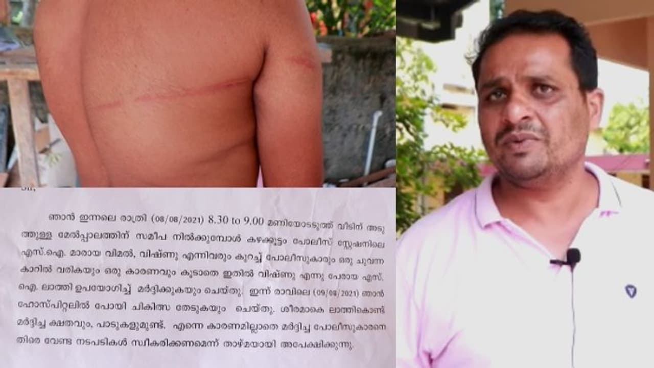 വീടിന് സമീപത്ത് നിന്ന യുവാവിനെ പൊലീസ് അകാരണമായി മർദ്ദിച്ചെന്ന് പരാതി, സംഭവം കഴക്കൂട്ടത്ത് വീടിന് സമീപത്ത് നിന്ന യുവാവിനെ പൊലീസ് അകാരണമായി മർദ്ദിച്ചെന്ന് പരാതി, സംഭവം കഴക്കൂട്ടത്ത്